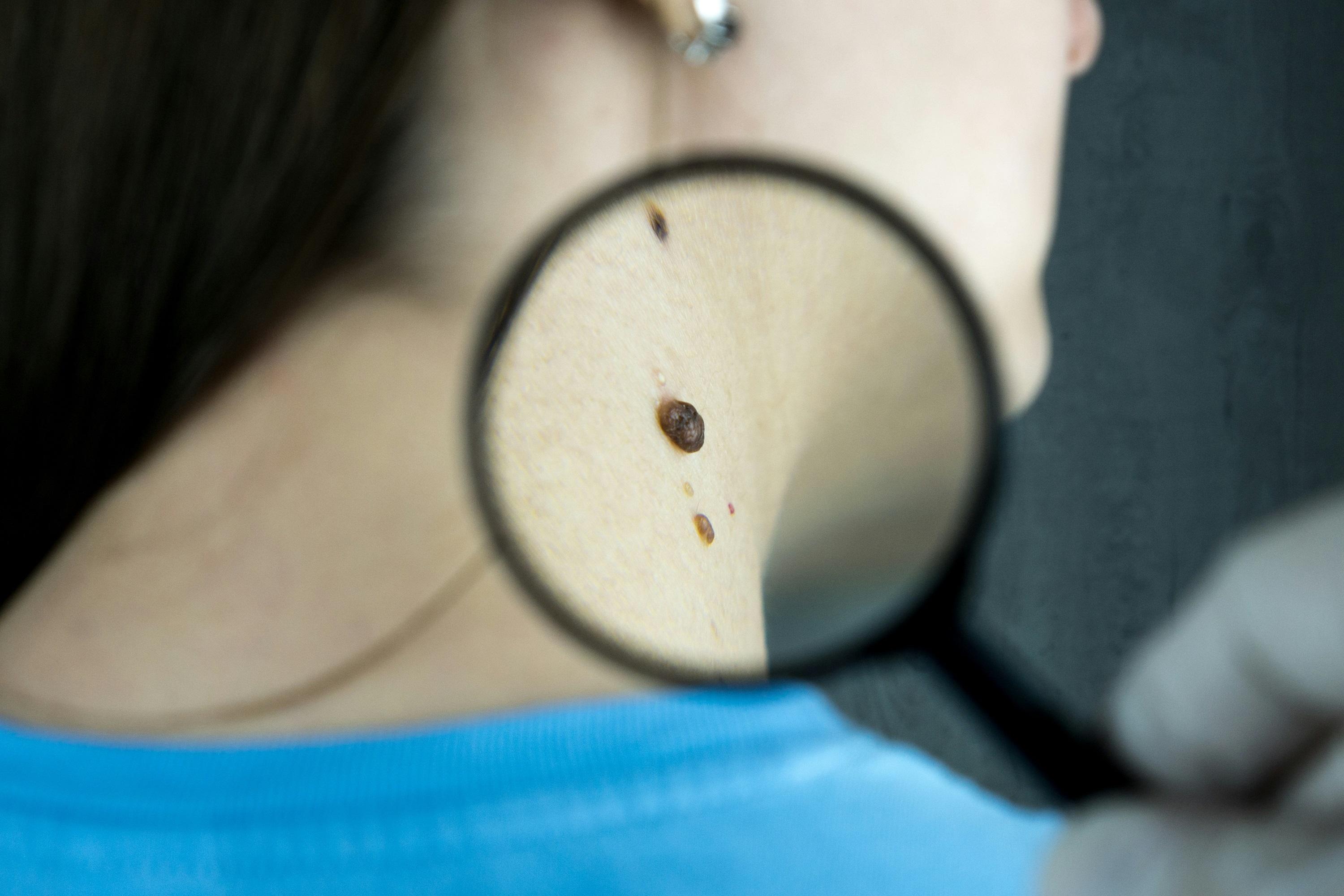 Dermatologues en France